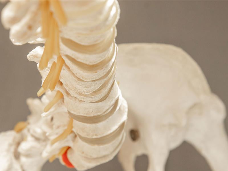 Rug- en nekschool uitgevoerd door Impakt Kiné, Essen - Wuustwezel